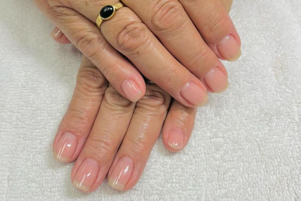 nail health signs meaning