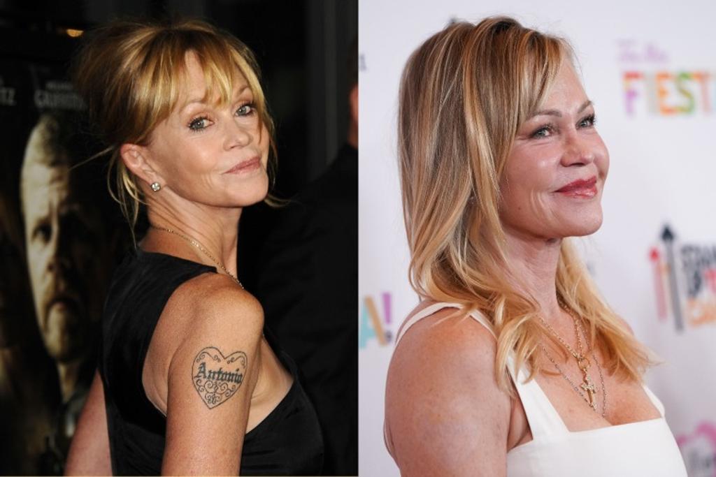 Celebrity Exes Tattoo Removal 