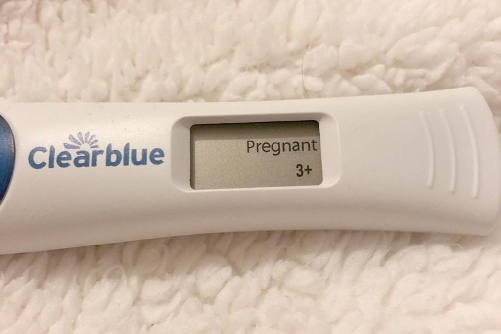 rare pregnancy story viral